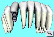 3D