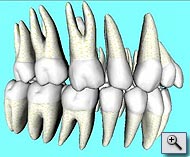 3D